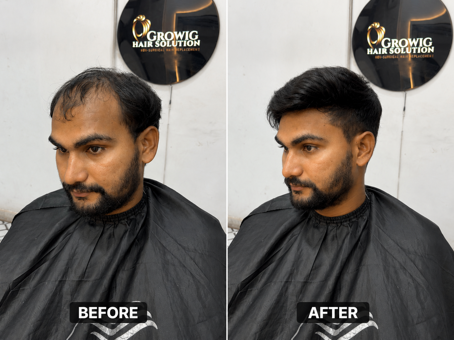 Bespoke Hairline Designing