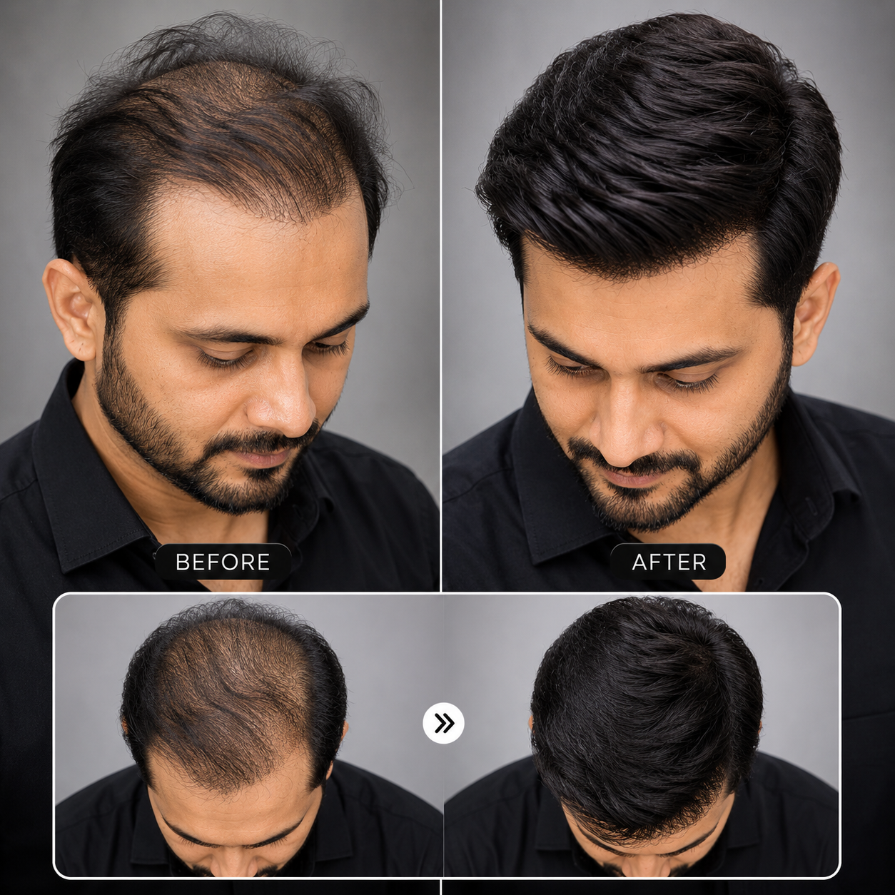 Before and After