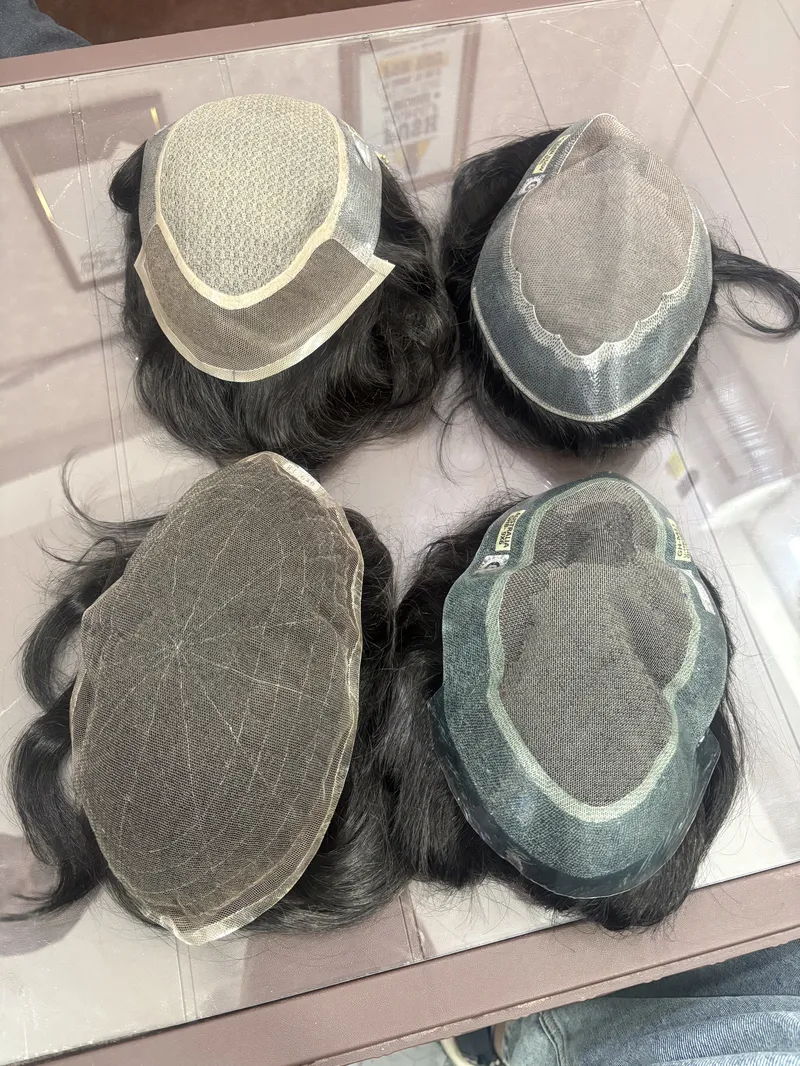 Before and After Hair Transformation