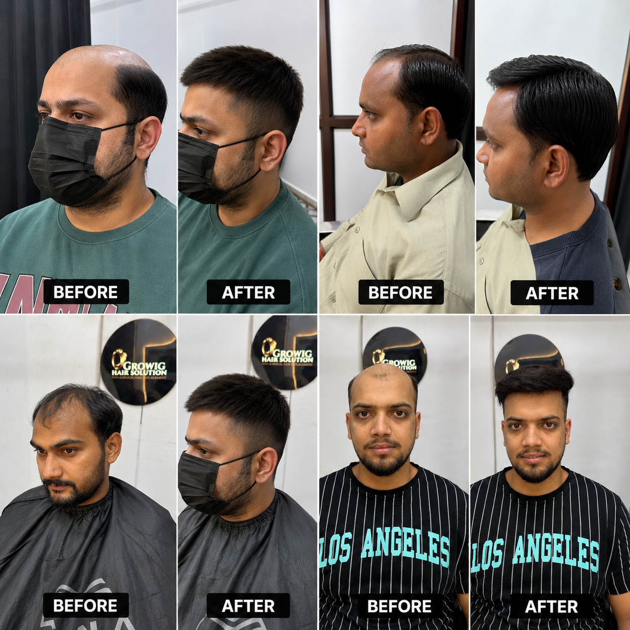 Best Wig Shop in DLF Phase 2