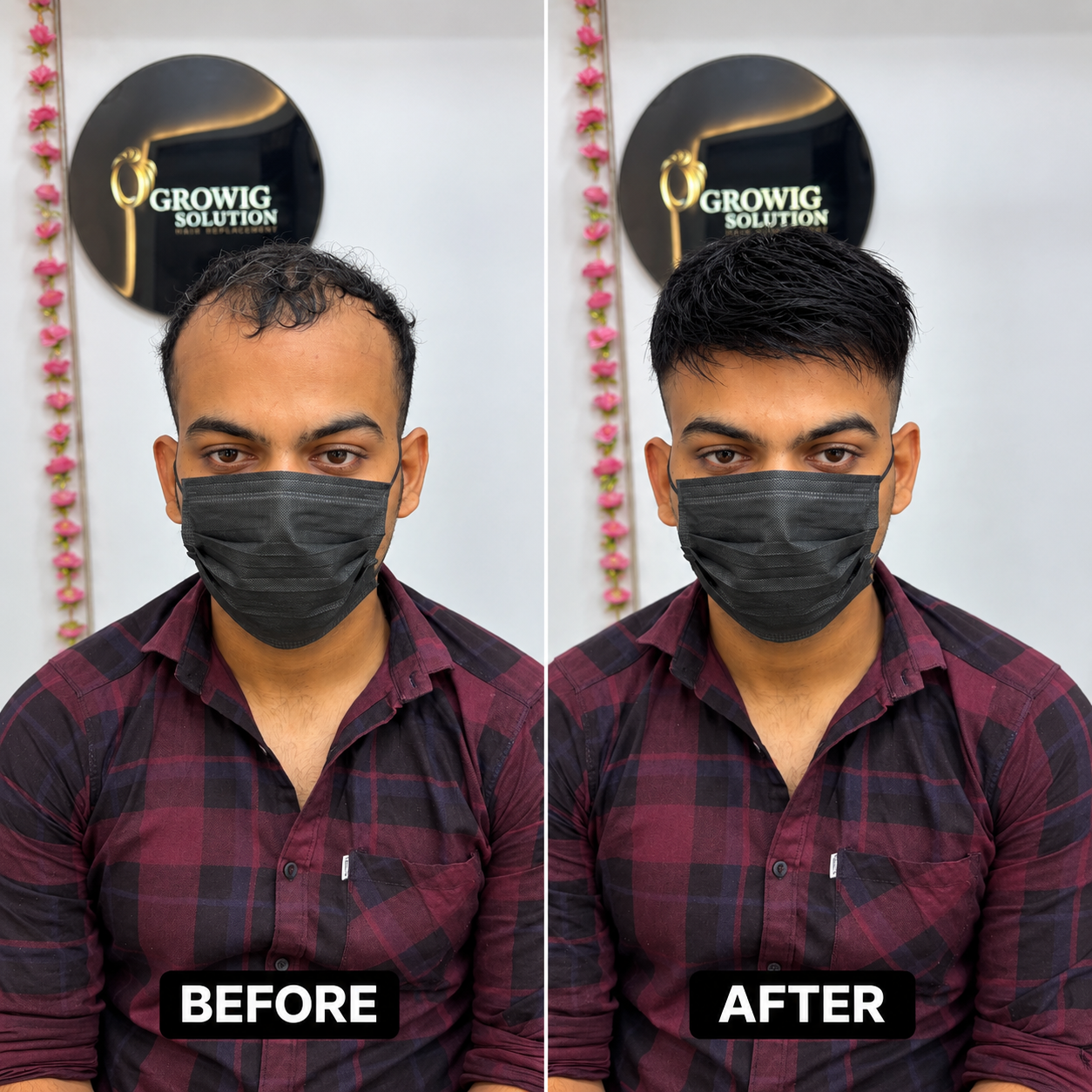Custom Full Hair Wig - Before and After