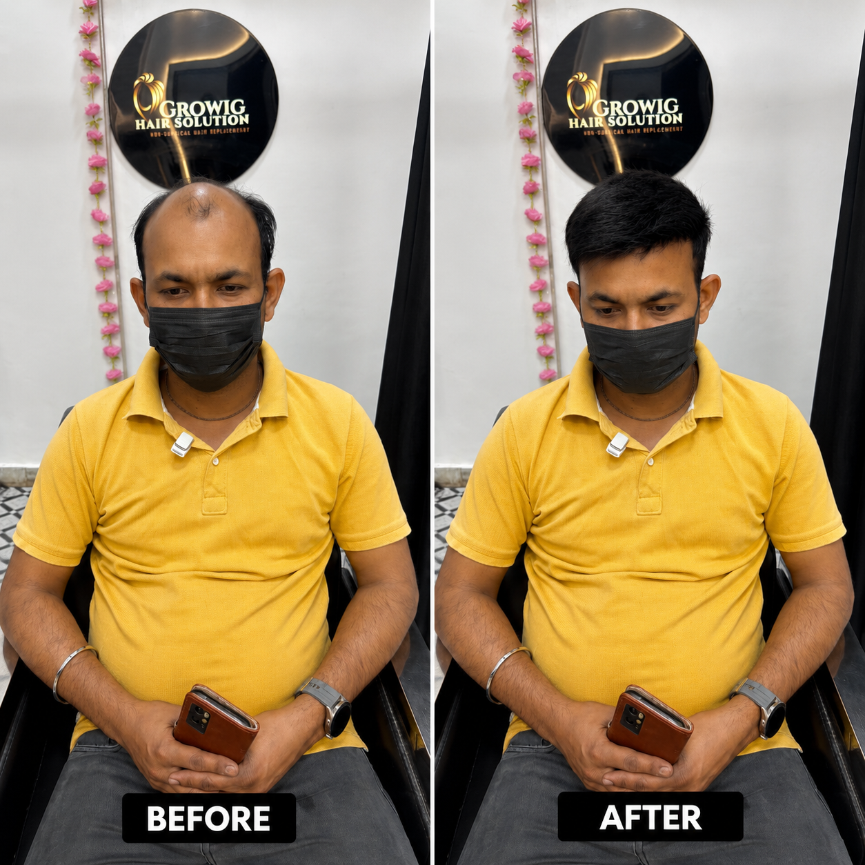 Premium Hair Bonding