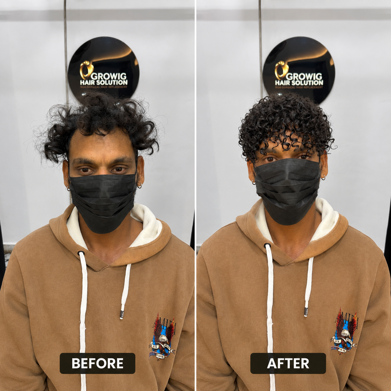 Premium Non-Surgical Hair Replacement